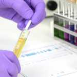 Pre-employment drug screening